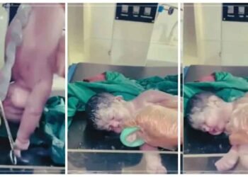 એમ જ નથી કહેતા ડૉક્ટરને ભગવાનનું રૂપ, ગર્ભમાં મરી ગયેલું બાળકને શ્વાસ પાછા લાવ્યા, 4 મિનિટ સુધી યમરાજ સાથે લડ્યો!