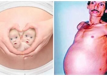 આ વ્યક્તિ 36 વર્ષ સુધી ગર્ભવતી રહ્યો, ફૂલેલા પેટને ટ્યુમર(ગાંઠ) સમજતો હતો, પછી જોડિયા બાળકોને જન્મ આપ્યો