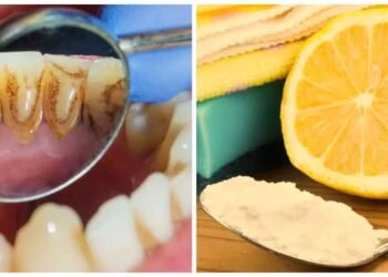 20 રૂપિયાની આ 2 વસ્તુઓ જડી દુર કરશે દાંતની પીળી ગંદકી, મોતી જેવા ચમકશે તમારા 32 દાંત