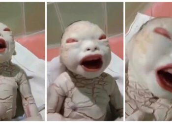 મહિલાએ ‘એલિયન’ જેવા બાળકને જન્મ આપ્યો, ડોક્ટરો પણ ચોંકી ગયા, જુઓ VIDEO