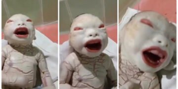 મહિલાએ ‘એલિયન’ જેવા બાળકને જન્મ આપ્યો, ડોક્ટરો પણ ચોંકી ગયા, જુઓ VIDEO