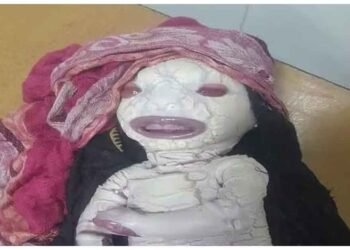 અહીં યુપીમાં એક વિચિત્ર બાળકનો જન્મ થયો… પુત્રને જોઈને માતા ચોંકી ગઈ! લોકો એલિયન્સ કહી રહ્યા છે