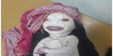 અહીં યુપીમાં એક વિચિત્ર બાળકનો જન્મ થયો… પુત્રને જોઈને માતા ચોંકી ગઈ! લોકો એલિયન્સ કહી રહ્યા છે