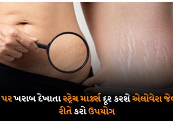 શરીર પર ખરાબ દેખાતા સ્ટ્રેચ માર્ક્સ દૂર કરશે એલોવેરા જેલ, આ રીતે કરો ઉપયોગ