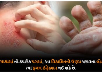 ક્યારેક માથામાં તો ક્યારેક પગમાં, આ વિટામિનની ઉણપ ધરાવતા લોકોને ગમે ત્યાં ફંગલ ઇન્ફેક્શન થઈ શકે છે.