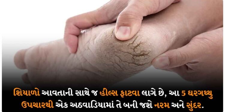 શિયાળો આવતાની સાથે જ હીલ્સ ફાટવા લાગે છે, આ 5 ઘરગથ્થુ ઉપચારથી એક અઠવાડિયામાં તે બની જશે નરમ અને સુંદર.